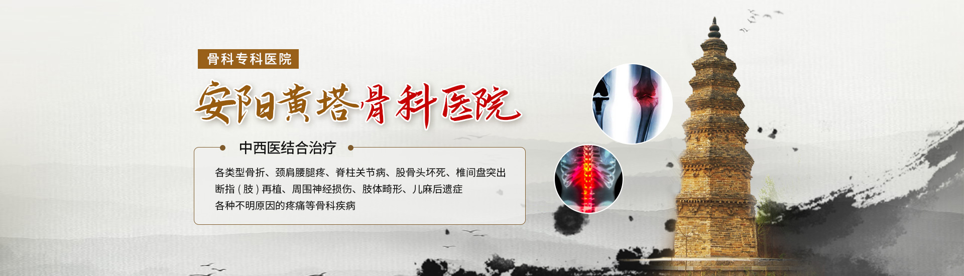 安陽(yáng)骨科|安陽(yáng)骨科醫(yī)院-安陽(yáng)黃塔骨科醫(yī)院